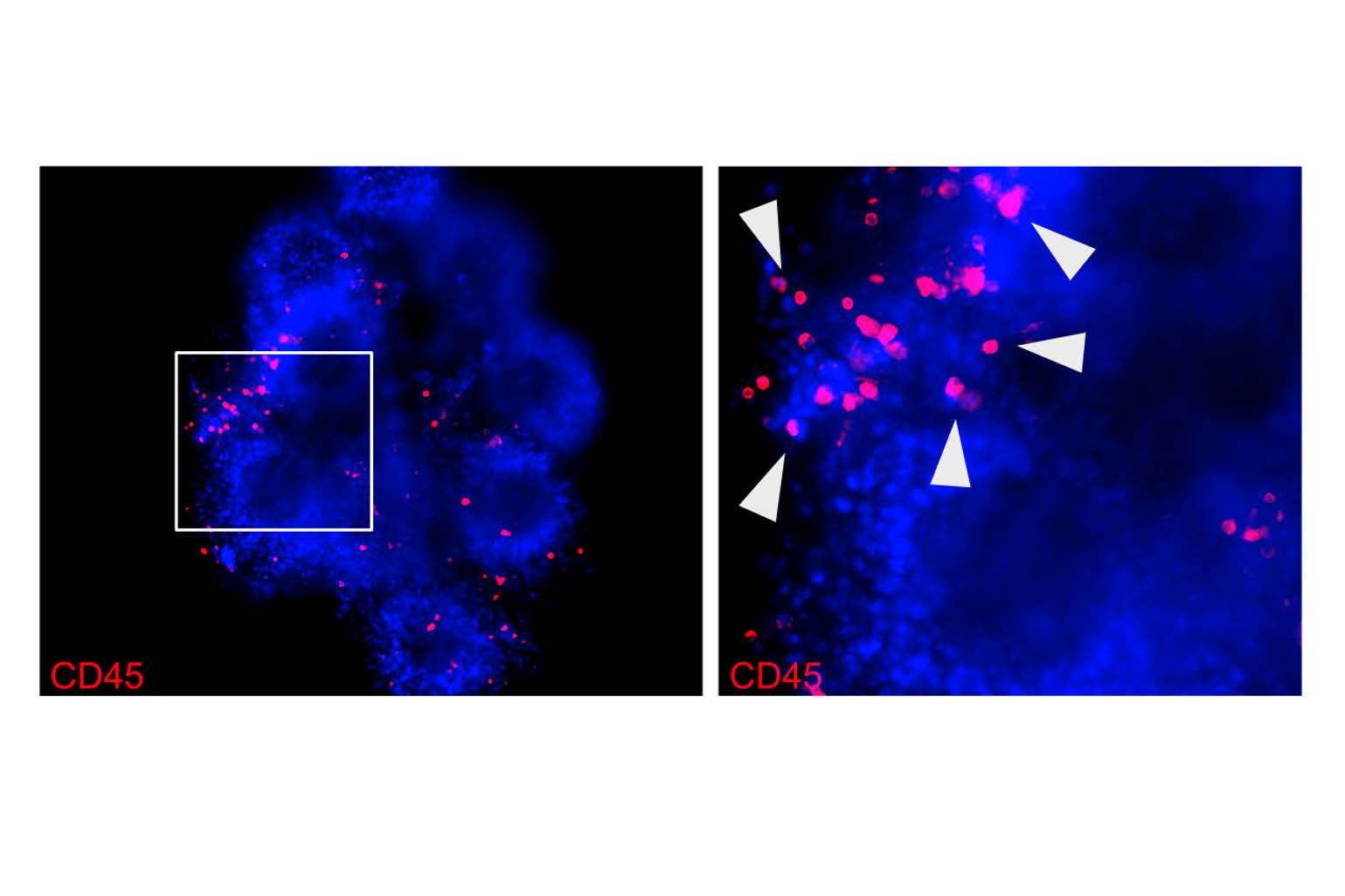 Illustration CD45 COC